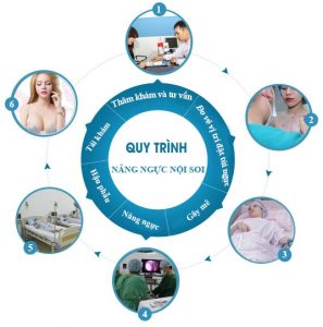 Quy trình thực hiện nâng ngực tại thẩm mỹ viện Kalian