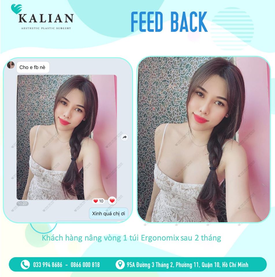 Hình ảnh phản hồi về dịch vụ nâng ngực nội soi bác sĩ Việt