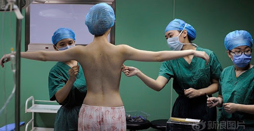 bác sĩ nâng ngực giỏi