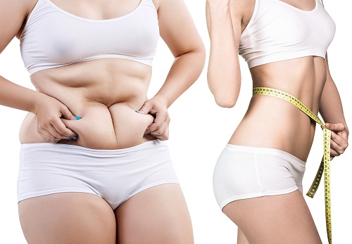 Hướng dẫn chăm sóc sau khi hút mỡ bụng