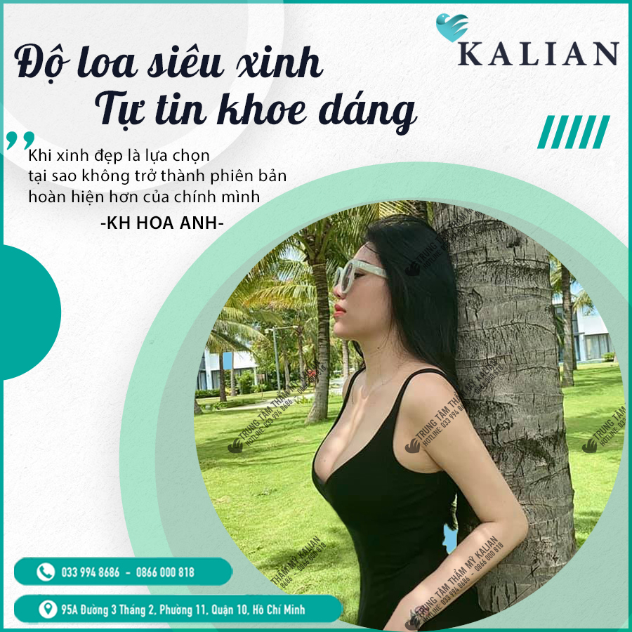 HÌnh nảnh nâng ngực nội soi 3 HÌnh nảnh nâng ngực nội soi 3