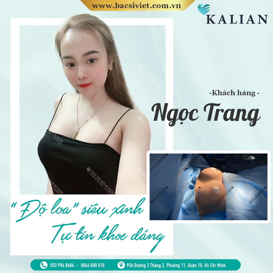 HÌnh nảnh nâng ngực nội soi 5 HÌnh nảnh nâng ngực nội soi 5