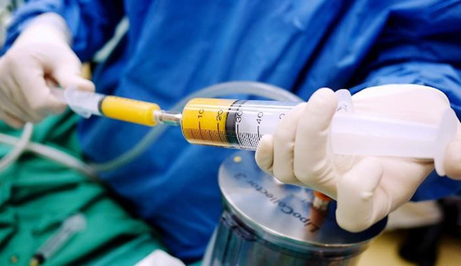 hut mo tao co kalian thẩm mỹ viện hút mỡ tạo cơ