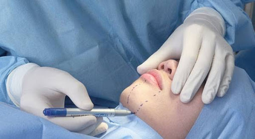 hút mỡ mặt bao nhiêu tiền hút mỡ mặt bao nhiêu tiền